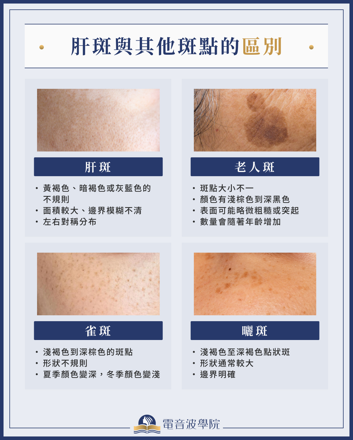 肝斑與其他斑點的區別