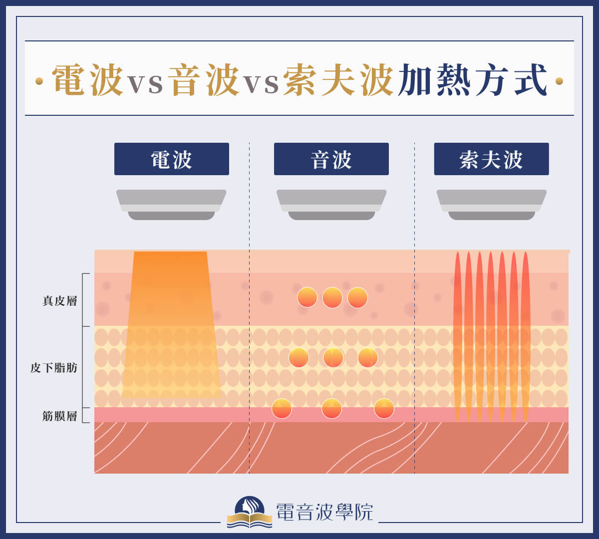 電波 vs 音波 vs 索夫波加熱方式