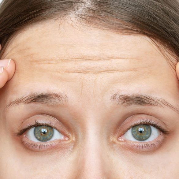 皺紋如何消除？解析7大醫美方式、教您選對療程養出逆齡肌膚！