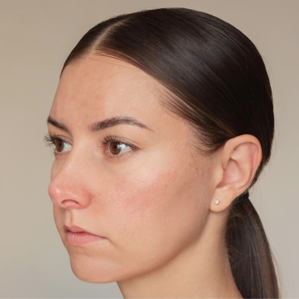 敏感肌、過敏肌怎麼分？6大常見敏感肌症狀、保養要點一次看