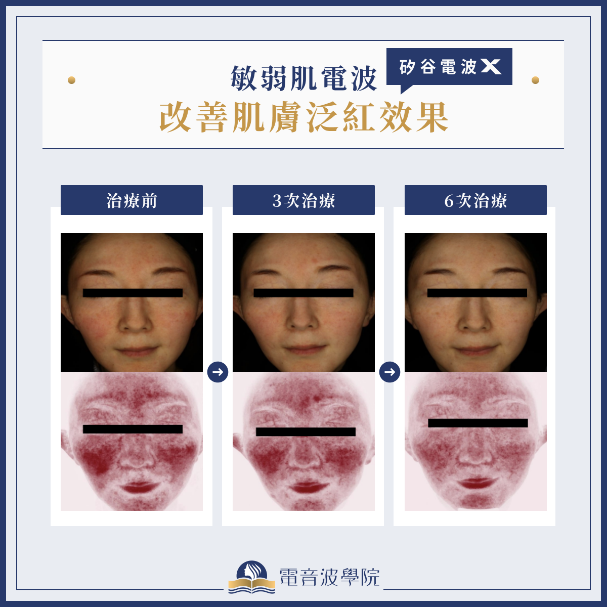 改善肌膚泛紅效果