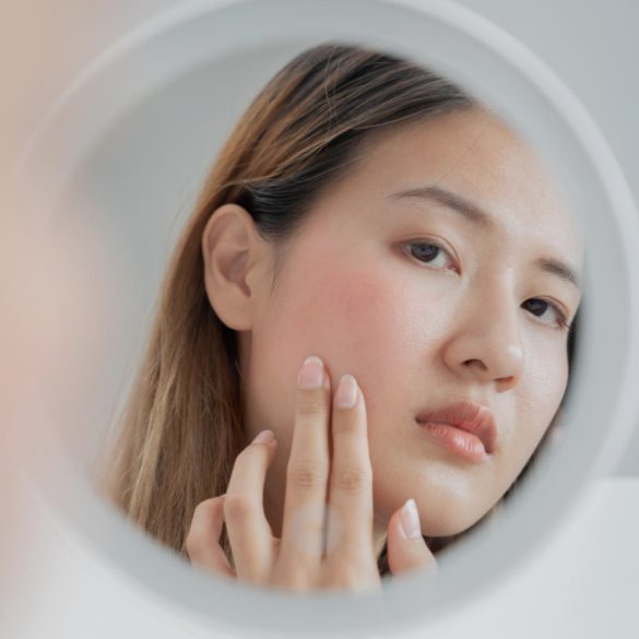 臉頰泛紅怎麼辦？7大臉頰泛紅原因＋5種改善方法全攻略