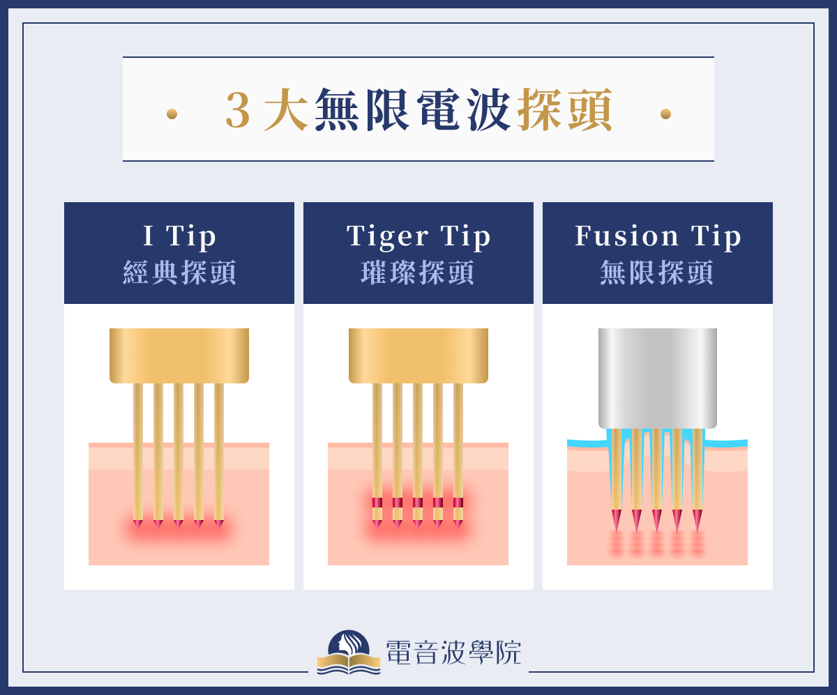 3 大無限電波探頭